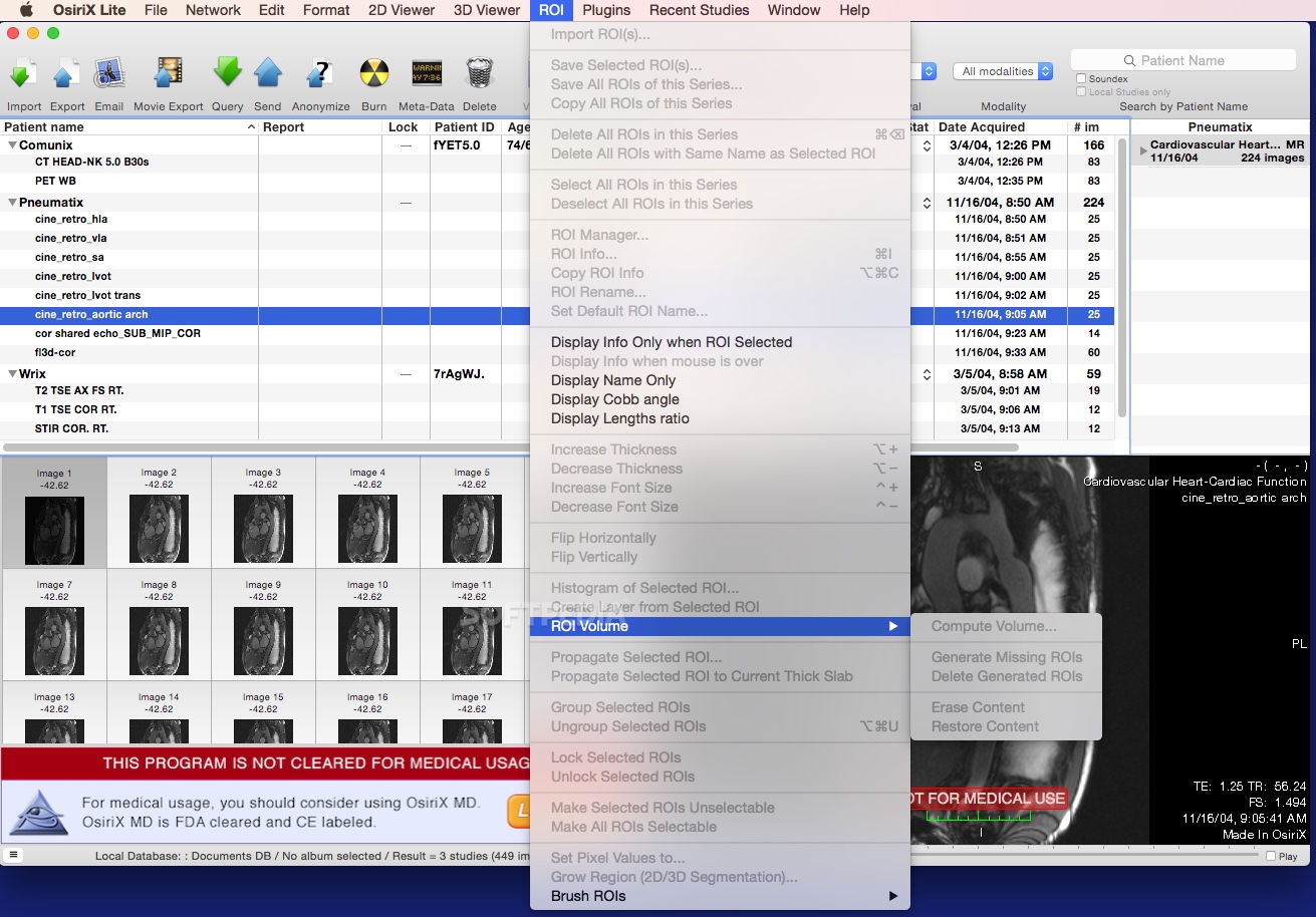 Osirix Free Download For Mac 10.6 8